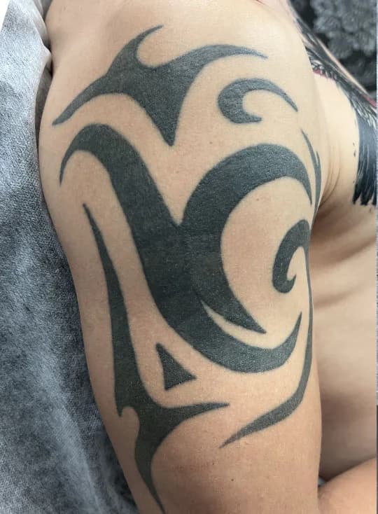 Večji tattoo pred laserskim odstranjevanjem